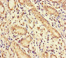 GUCY1A1 Antibody