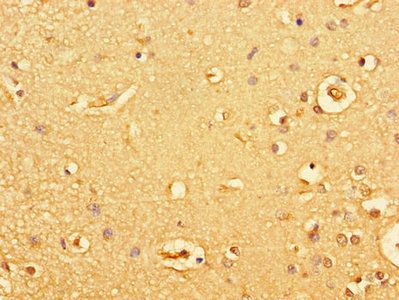 GUCY2C Antibody