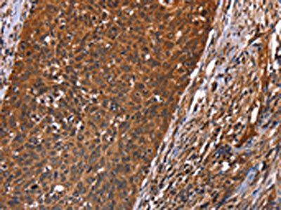 GUK1 Antibody