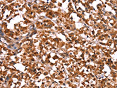 GUK1 Antibody