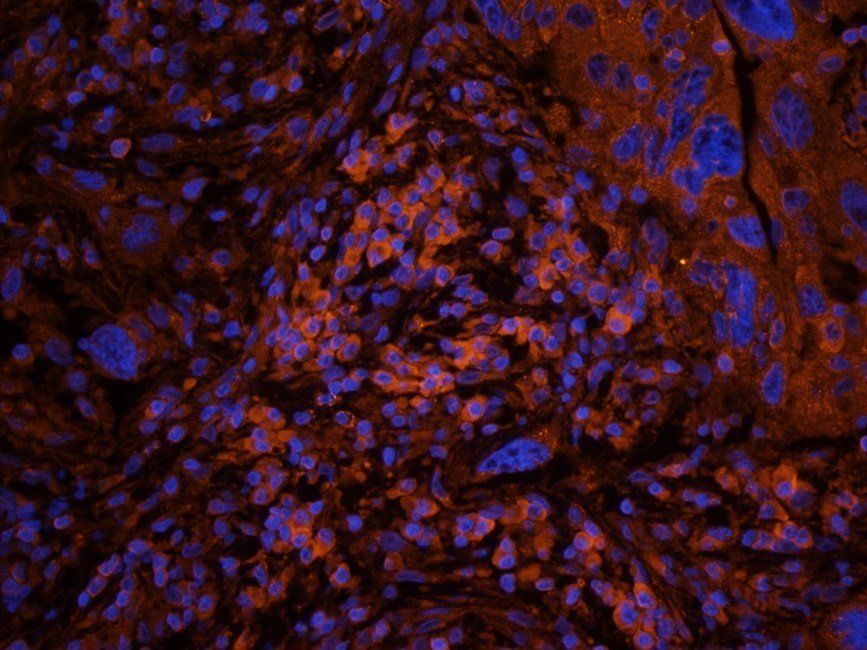 GYG1 antibody