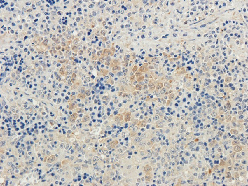 GYG1 antibody