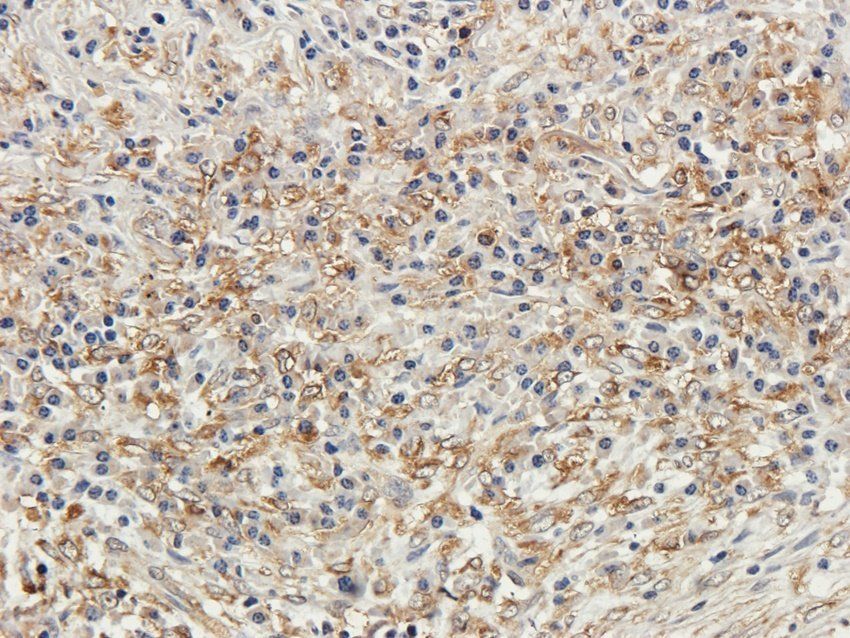 GYG1 antibody