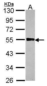 glycogenin 2 Antibody