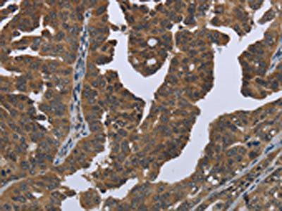 GYS2 Antibody