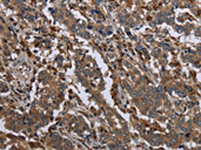 GYS2 Antibody