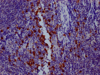 GZMB Recombinant Monoclonal Antibody