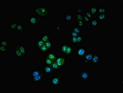 GZMH Antibody