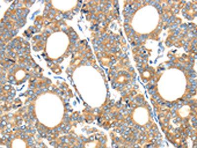 GZMK Antibody