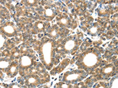 GZMK Antibody