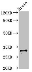 H-2 class II histocompatibility gamma chain antibody