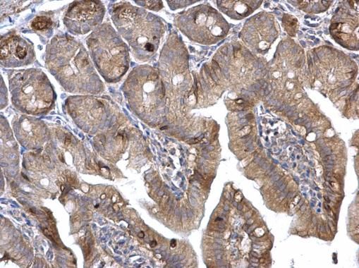 H-Ras antibody