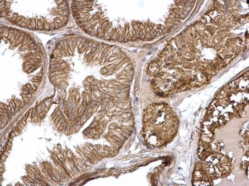 H-Ras antibody