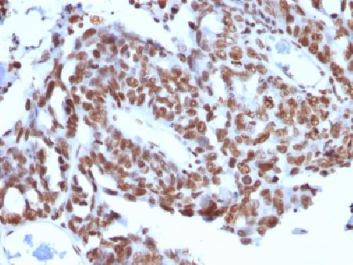 H1 antibody