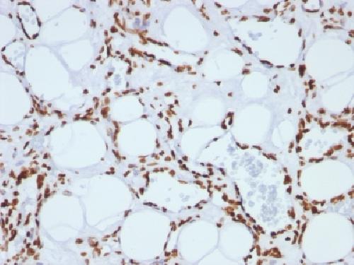 H1 antibody