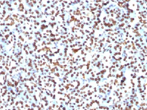 H1 antibody