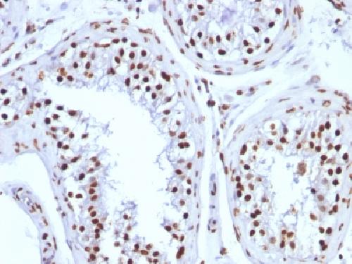 H1 antibody