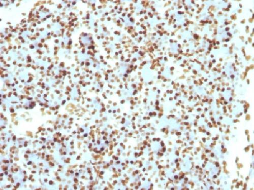 H1 antibody