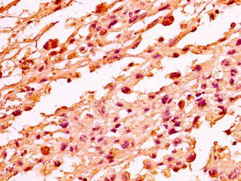 H1F0 (Ab-101) Antibody
