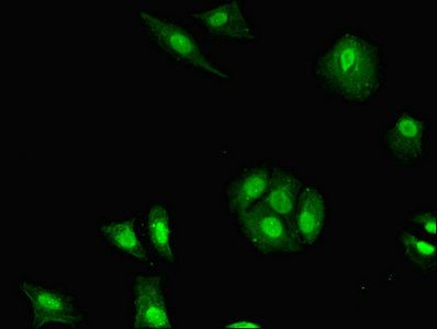 H2AFB1 Antibody