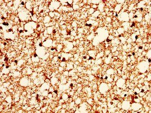 H2AFX Antibody