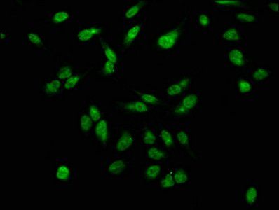 Phospho-H2AFX (S139) Antibody