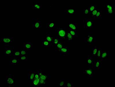Phospho-H2AFX (Y142) Antibody
