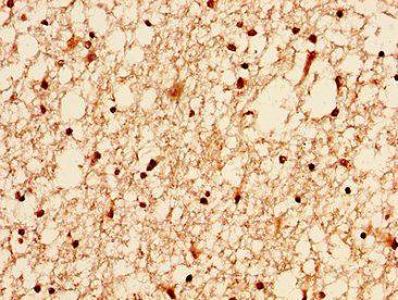 H2AFZ (Ab-4) Antibody