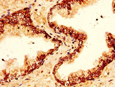 H2AFZ (Ab-4) Antibody