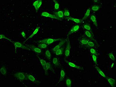 H2AFZ (Ab-4) Antibody