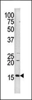 H3 (phospho-Ser10) antibody