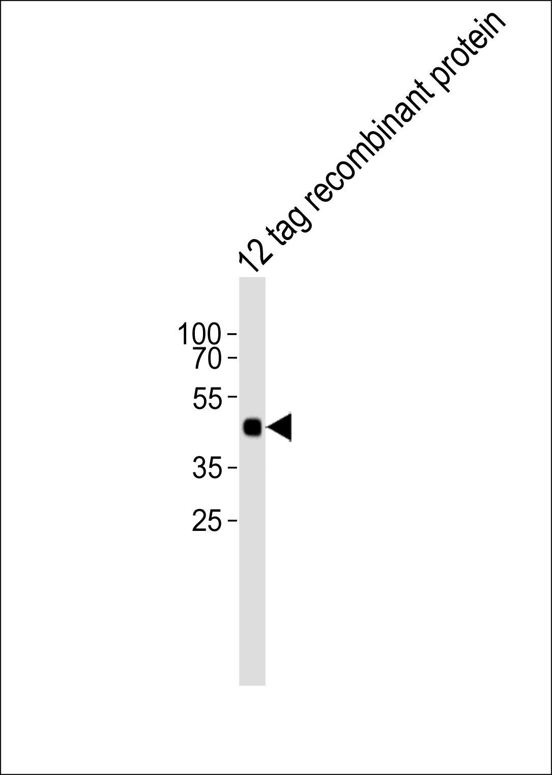 HA Tag antibody