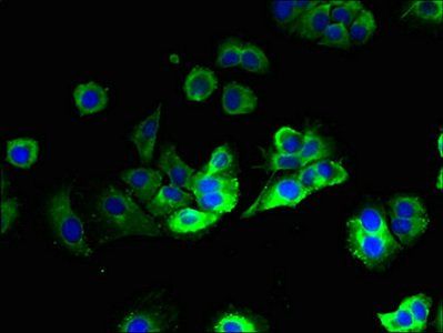 HACD2 Antibody