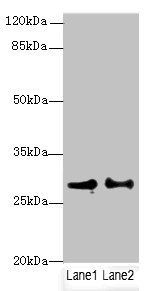 HACD2 antibody