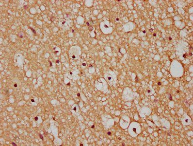 HACD3 Antibody