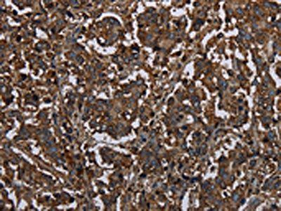 HACL1 Antibody