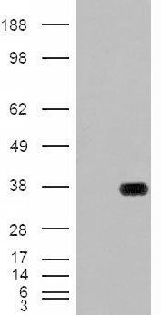 HADH antibody