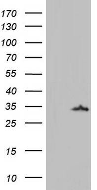 TSC1 Antibody