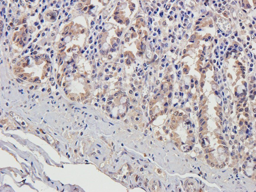 HAND1 antibody