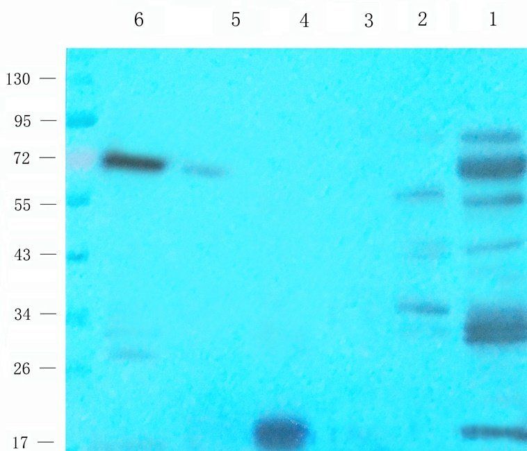 HAND1 antibody