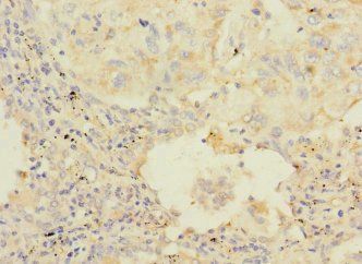 HAND1 Antibody