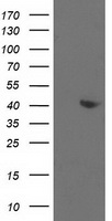 HAO1 Antibody