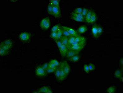 HAO1 Antibody