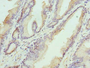 HAPLN1 Antibody