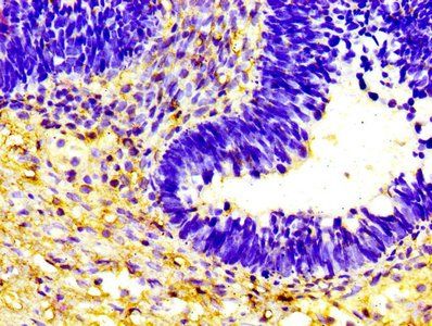 HP Antibody