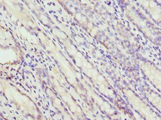HP Antibody