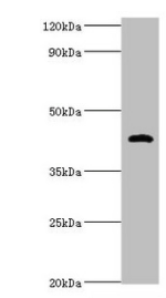 Haptoglobin antibody