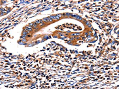 HP Antibody