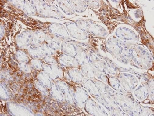 Haptoglobin Rabbit Polyclonal Antibody