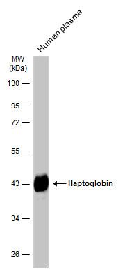 Haptoglobin Rabbit Polyclonal Antibody